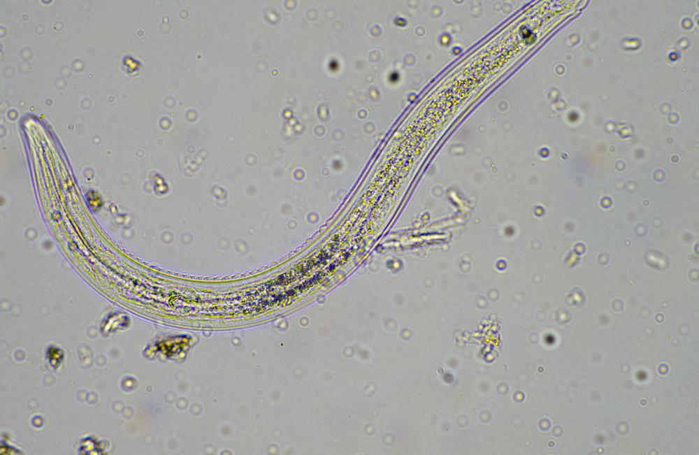 Nematode under MIcrscope